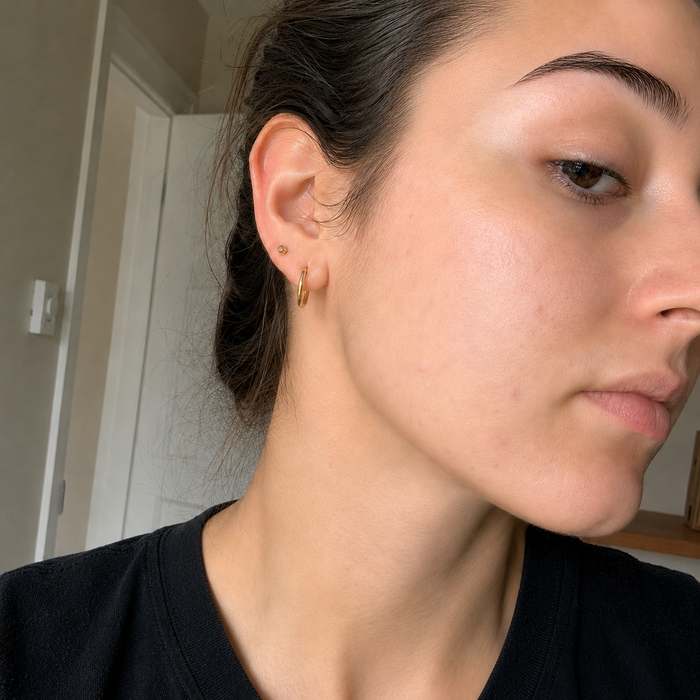 After — clearer-looking skin